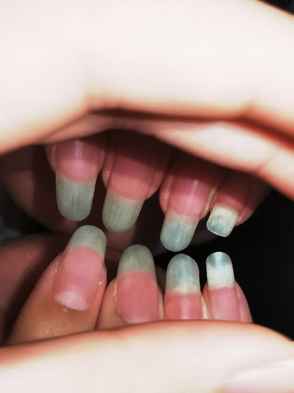 Teeth.🦷￼￼