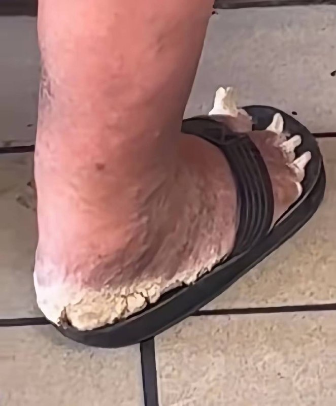 你们懂一个厌食症的人突然来了食欲的感觉吗？