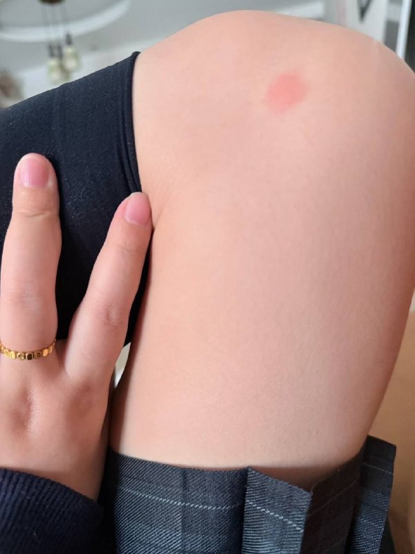 这蚊子真是无敌了这蚊子真是无敌了
