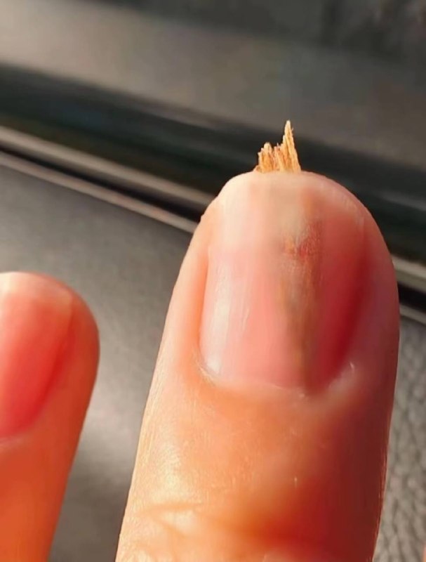 看着都疼系列