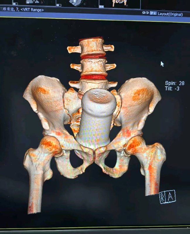 不小心坐进去的