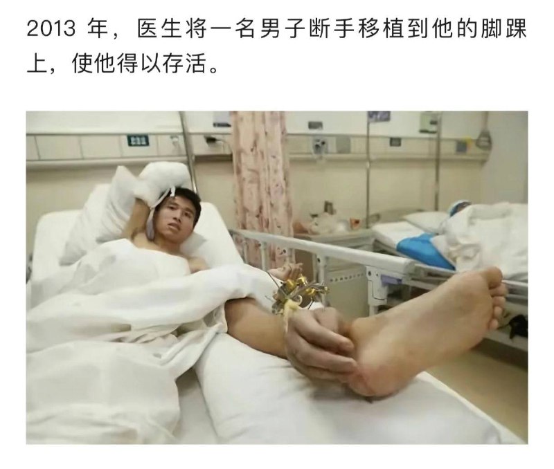 脚后跟刺挠还能挠一挠