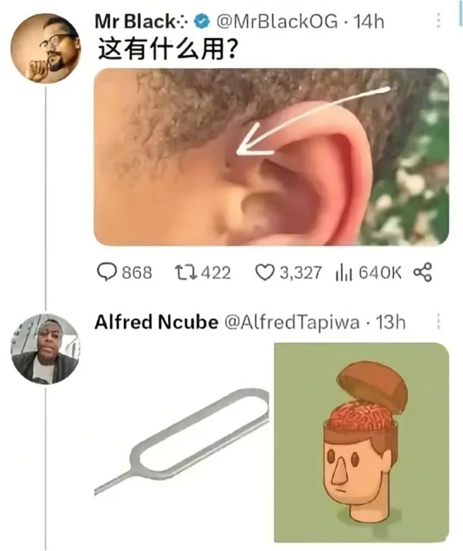 耳前窦道