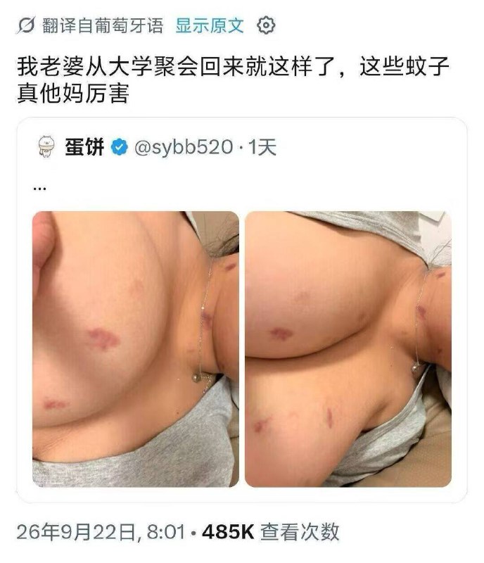 蚊子真厉害